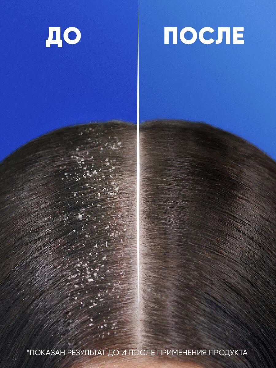 Шампунь Head&Shoulders "Ментол", для всех типов волос, 360 мл — фото 1