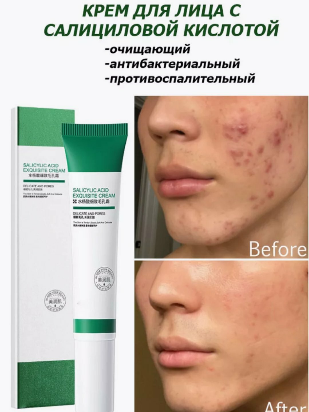 Крем для лица VEZE с салициловой кислотой, противовоспалительный, успокаивающий, 20 г