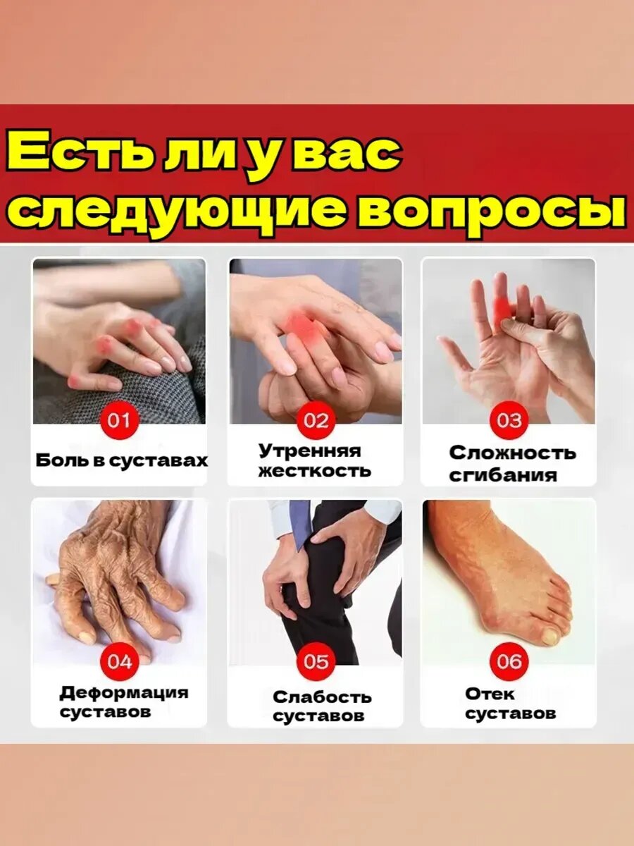 Препараты От Ревматоидного Артрита Мазь от боли при ревматоидном артрите 55 г