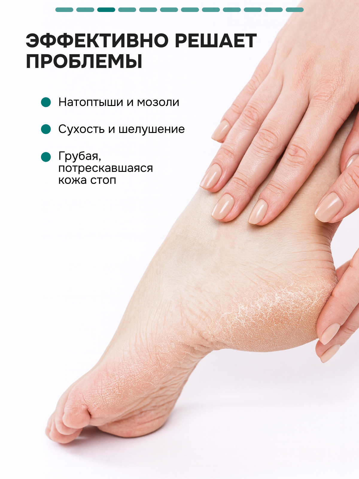 Кератолитик SEMILY, для гладких пяточек, против натоптышей, с мочевиной, 400 мл — фото 1