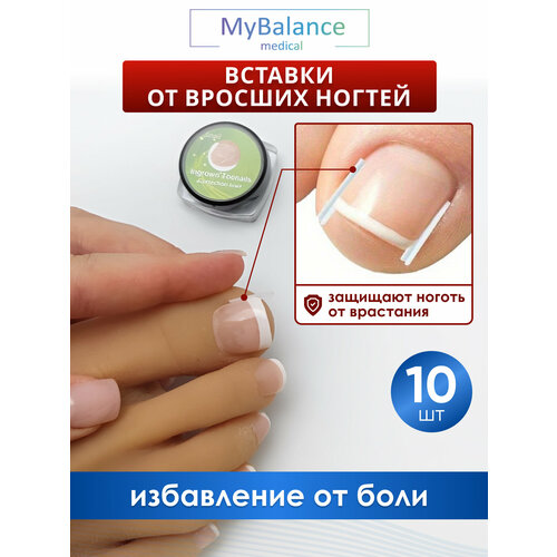 Вставка от вросшего ногтя в ногтевой валик