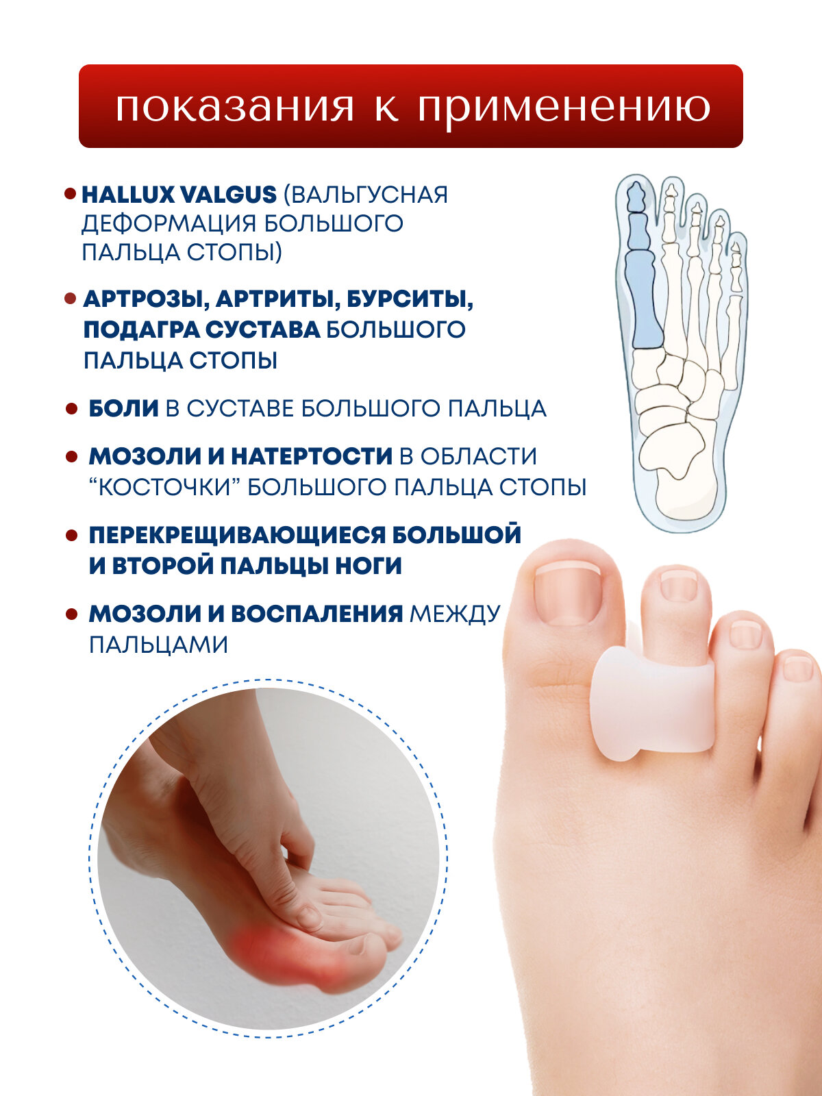 Картинки Корректоры пальцев MyBalance, силиконовые, цвет белый, размер M, 2 шт