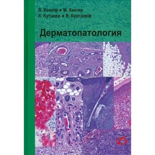 Кемпф, Ханчке, Кутцнер "Дерматопатология"