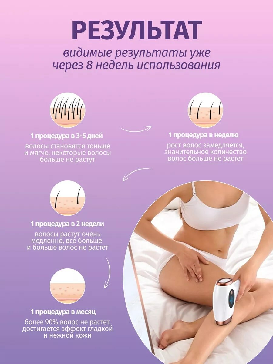 Фотоэпилятор, лазерный, 9 режимов, мощность вспышек 1.6-5Дж/см², белый — фото 1