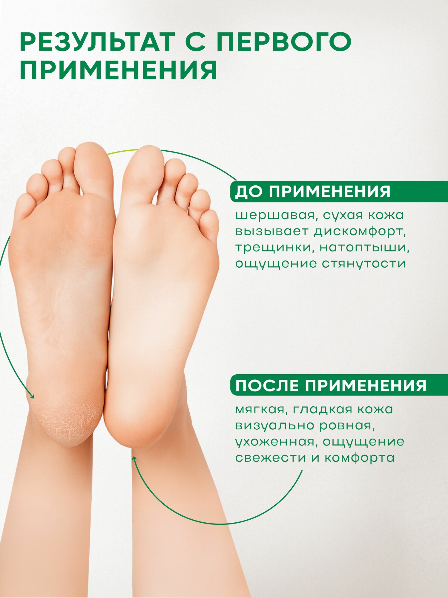 Маски Для Ног SKINLITE Отшелушивающие маски-носочки для ног, р.40-45, 2 шт