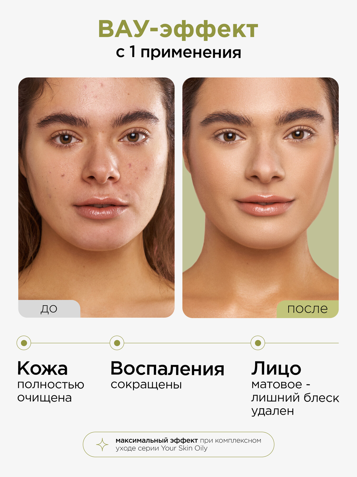 MIXIT Гель для умывания лица очищающий матирующий от прыщей, акне, черных точек — фото 1