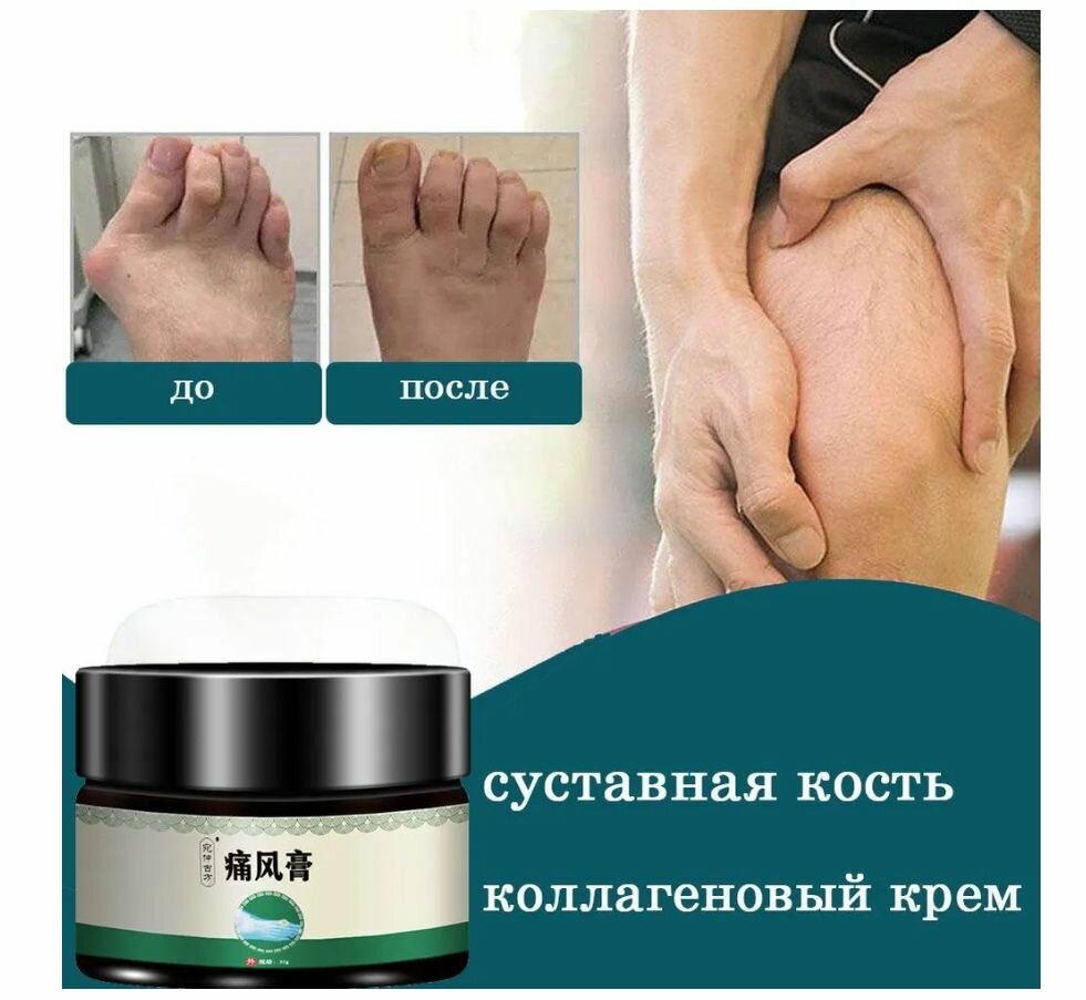 Мазь от подагры, для ног и коленного сустава, крем от боли в суставах, успокаивающий, восстанавливающий. 35 гр. фото