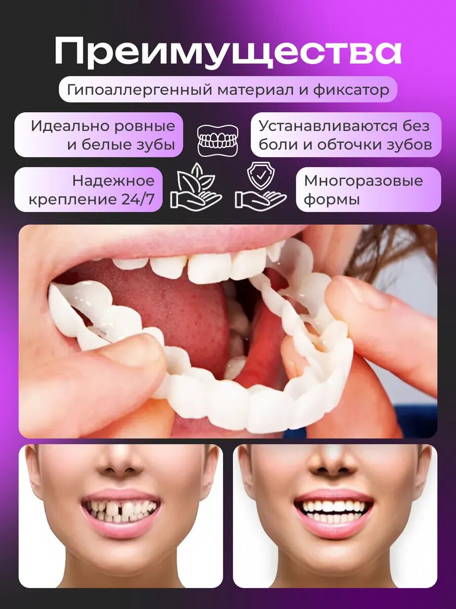 Виниры для зубов универсальные готовые зубные протезы — фото 1