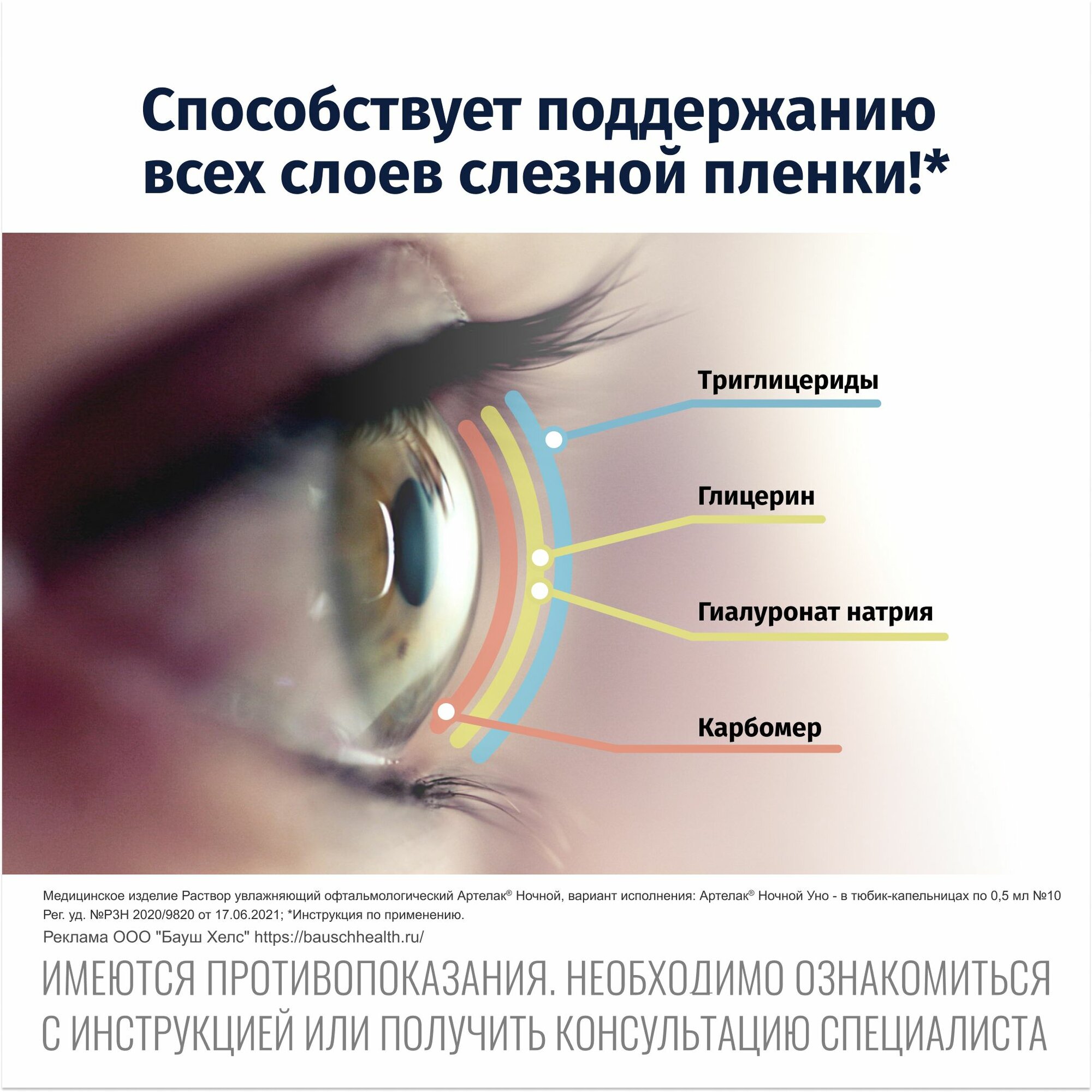 Растворы Офтальмологические Увлажняющие Капли для глаз увлажняющие раствор для линз Артелак Уно ночной 0,5 мл 10 шт