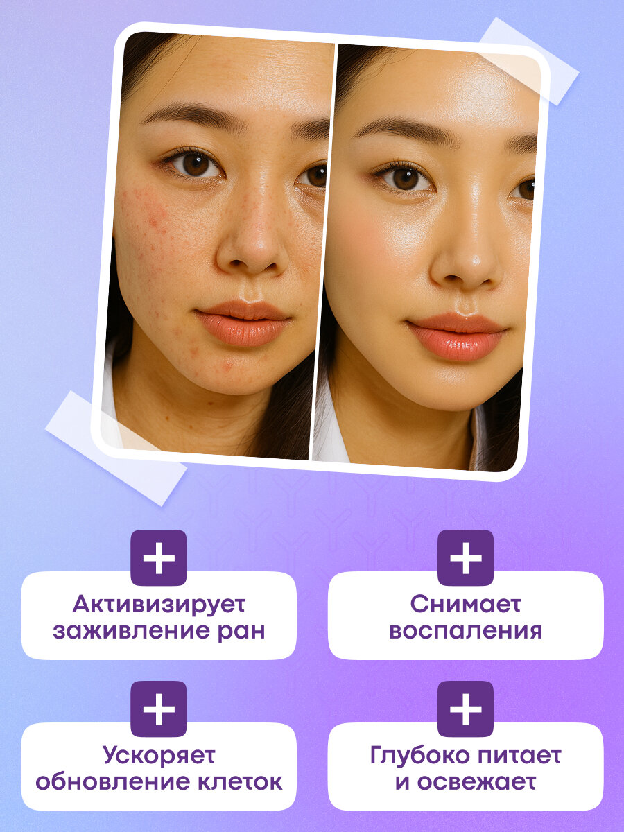 Маска для лица Yamaguchi Aloe, тканевая, с витамином B3, гиалуроновой кислотой, алоэ, 23 мл — фото 1