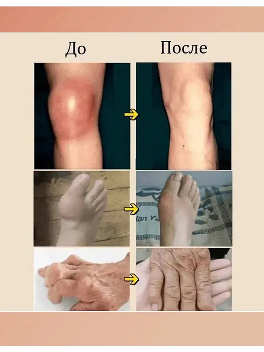Картинки ОбезболиваюшаЯ мазь длЯ суставов, 55 г