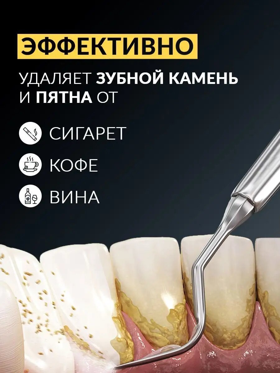 Скалер ультразвуковой Asia Care S401 для зубов, для домашнего использования, стоматологический — фото 1