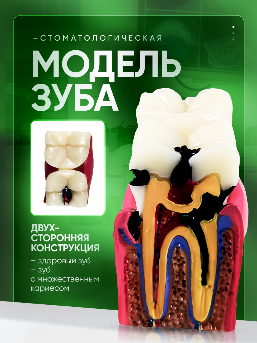 Стоматологическая модель зуба с кариесом и здоровым зубом Corpo Caries