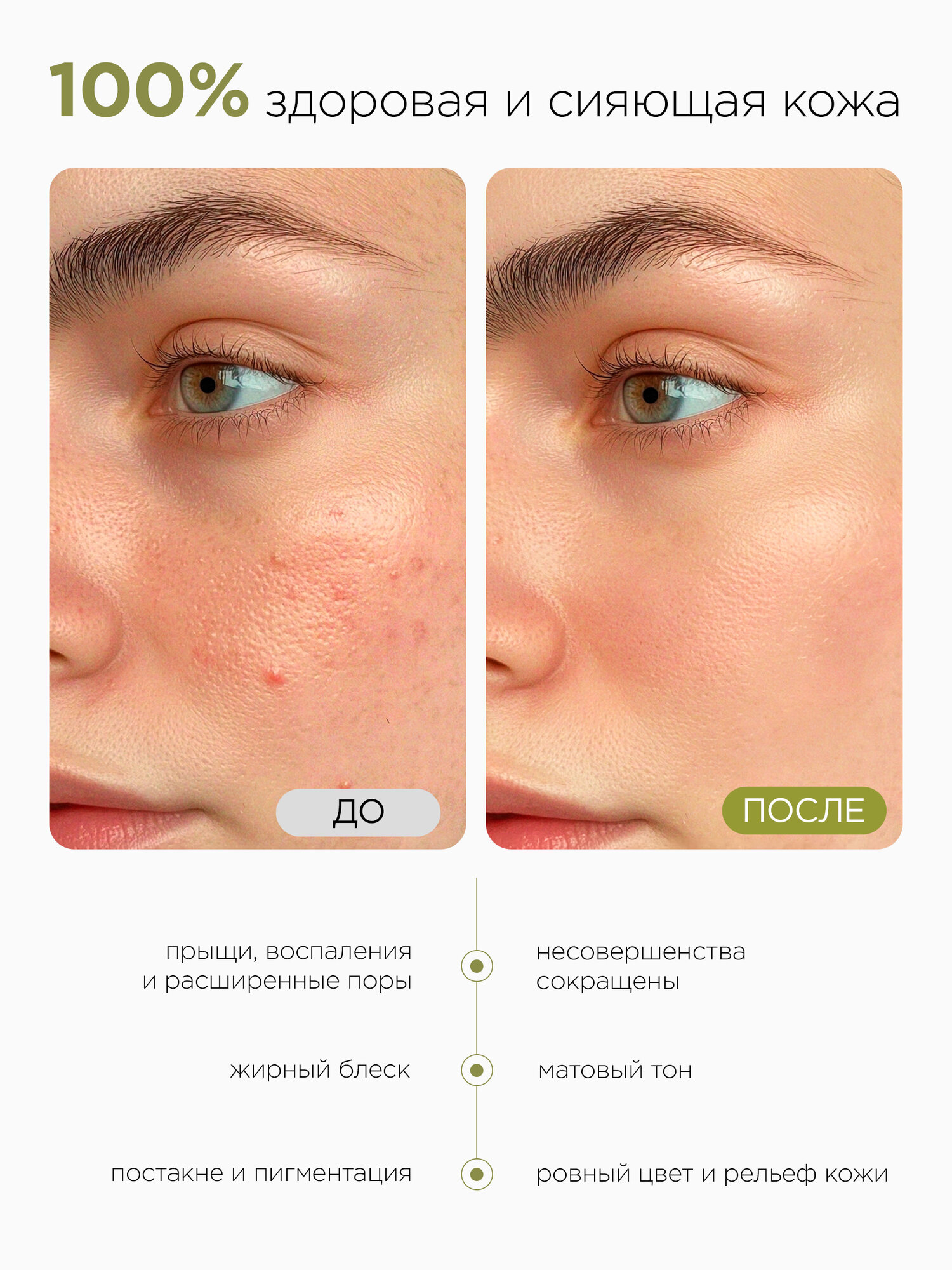 MIXIT Гель для умывания STOP ACNE, от прыщей, с кислотами, 250мл — фото 1