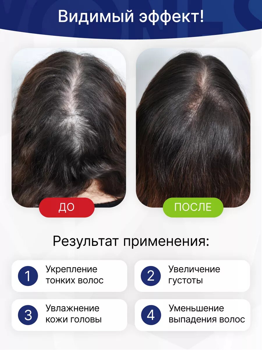 Картинки Сыворотка против выпадения и для роста волос с кератином, YONES, 50 мл