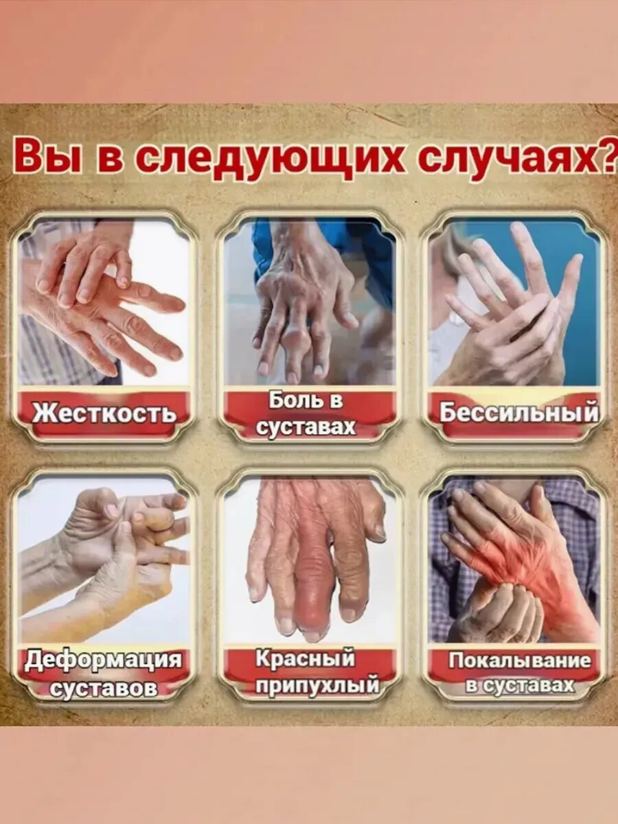 Картинки Мазь от ревматоидного артрита，55g