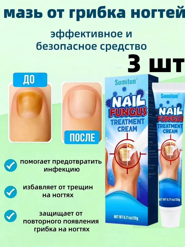 3 шт Средство от грибка ногтей на ногах; Противогрибковая мазь на основе натуральных компонентов,20 г