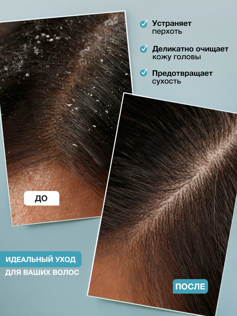 Tashe Пилинг для кожи головы глубокое очищение с охлаждающим эффектом, 100 мл — фото 1