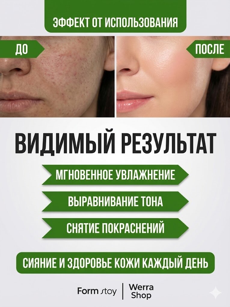 Маски тканевые для лица Form Stoy Aloe, с экстрактом алоэ вера, глубокое увлажнение и успокаивающий уход, 10 шт — фото 1