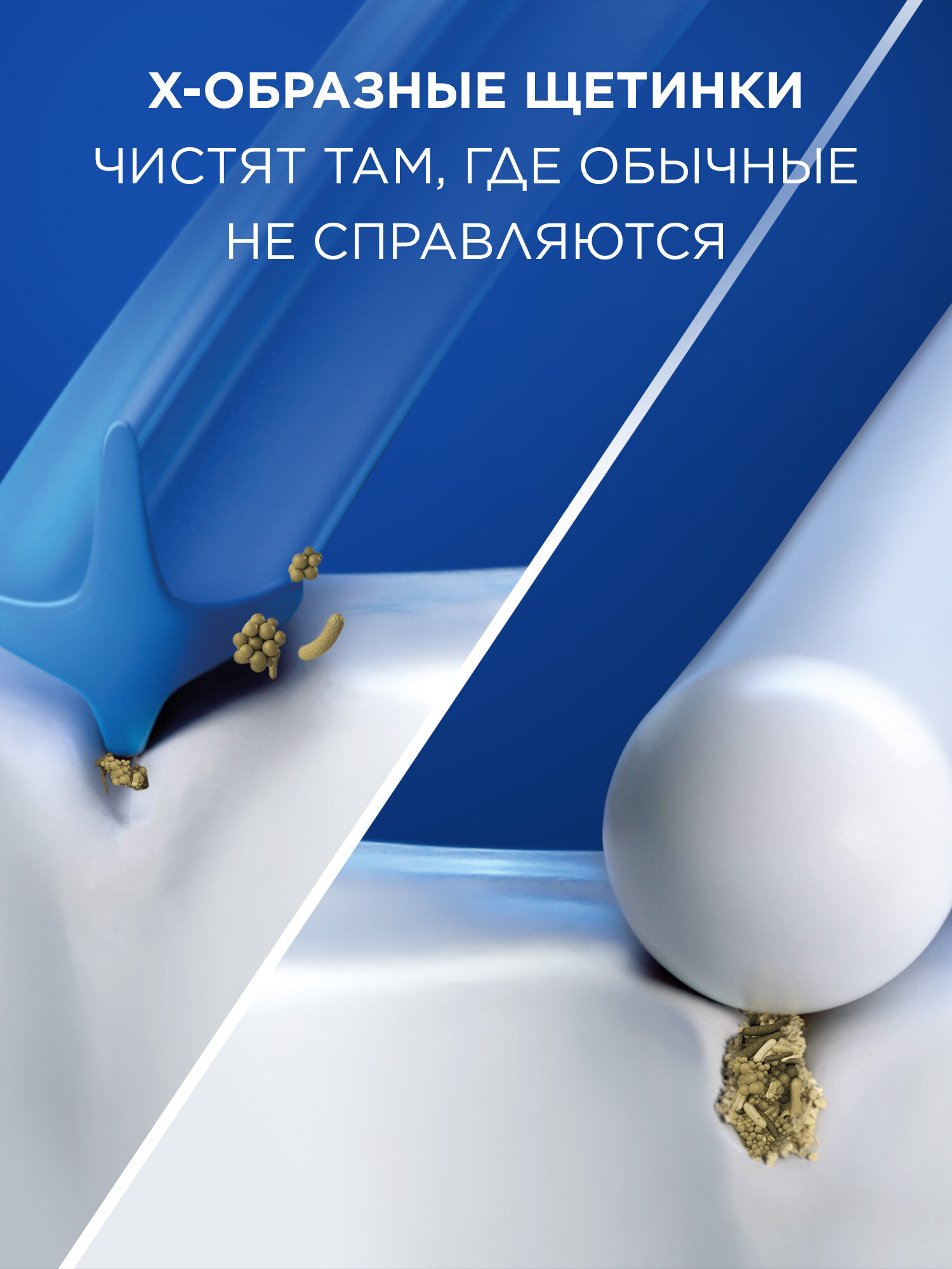 Набор насадок Oral-B Pro Cross Action для  ирригатора и электрической щетки, средняя, белый, 6 шт. — фото 1