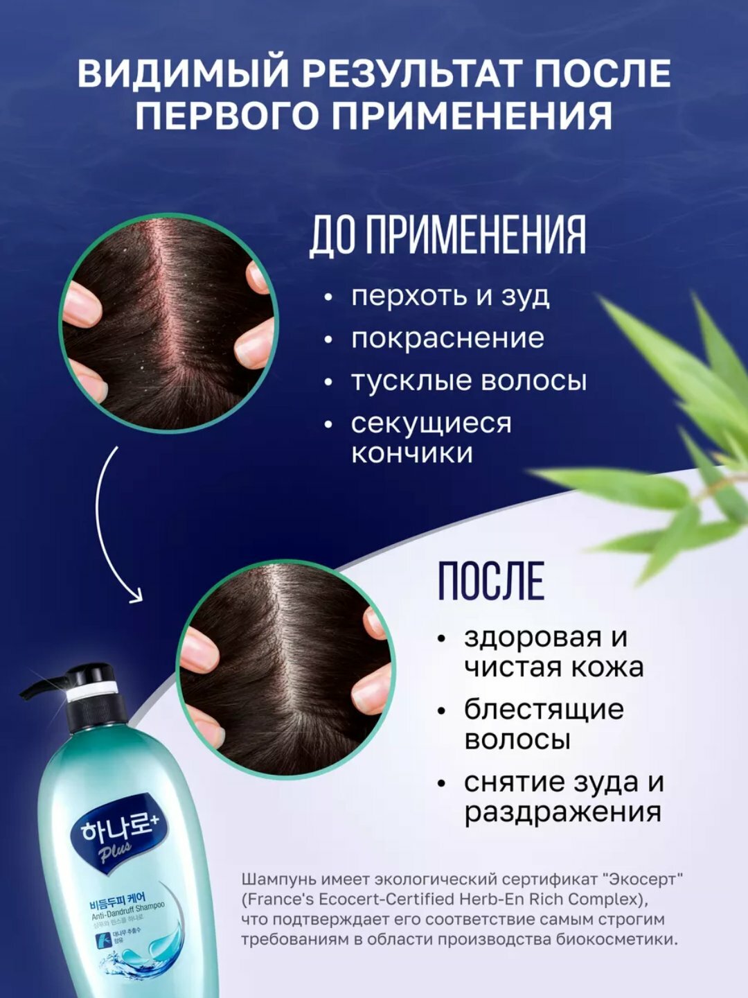 Шампунь-кондиционер Kerasys "Hanaro", против перхоти, 680 мл — фото 1