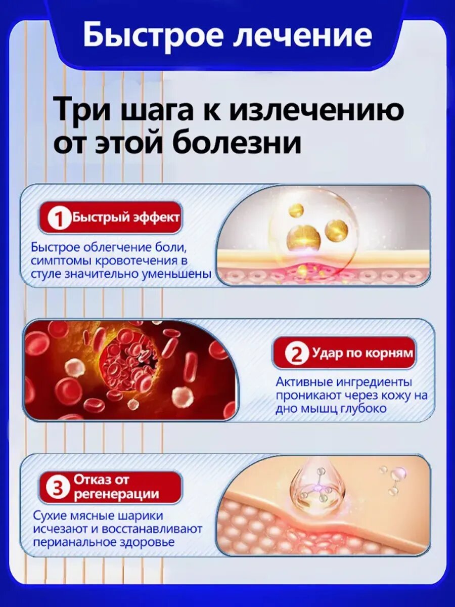 Изображение Китайская крем мазь от геморроя，20 г