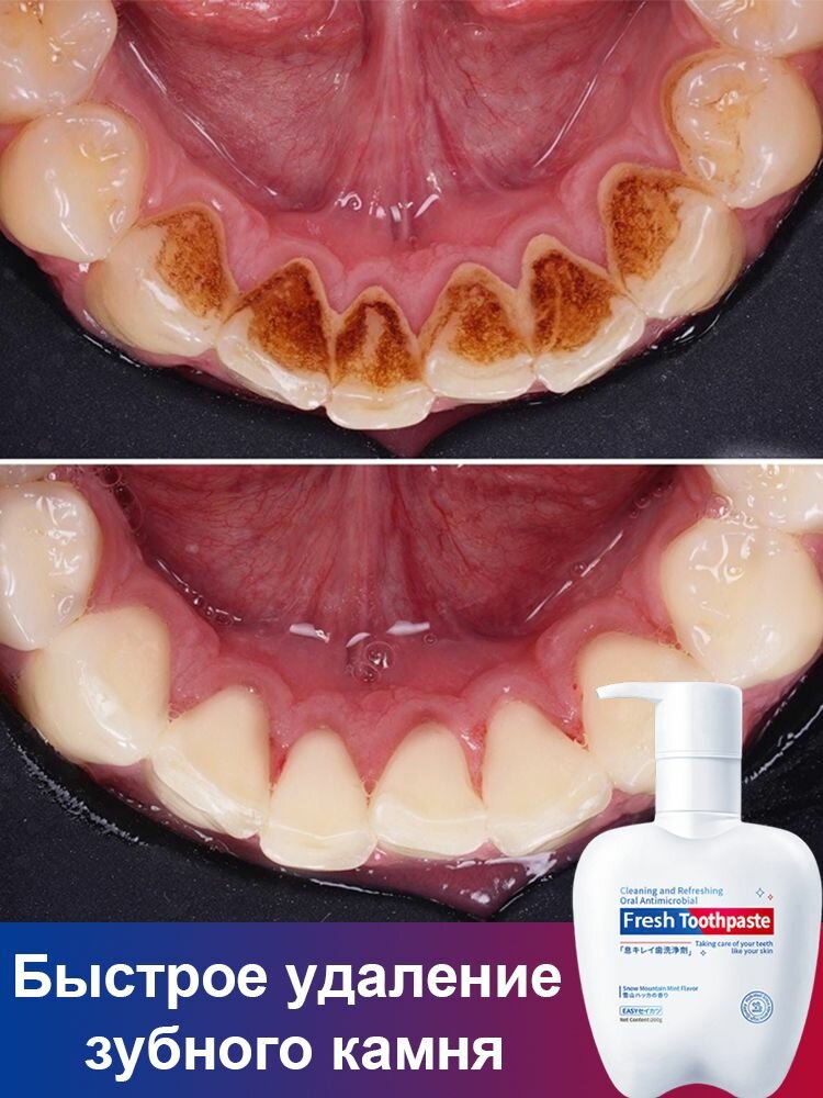 Зубная паста