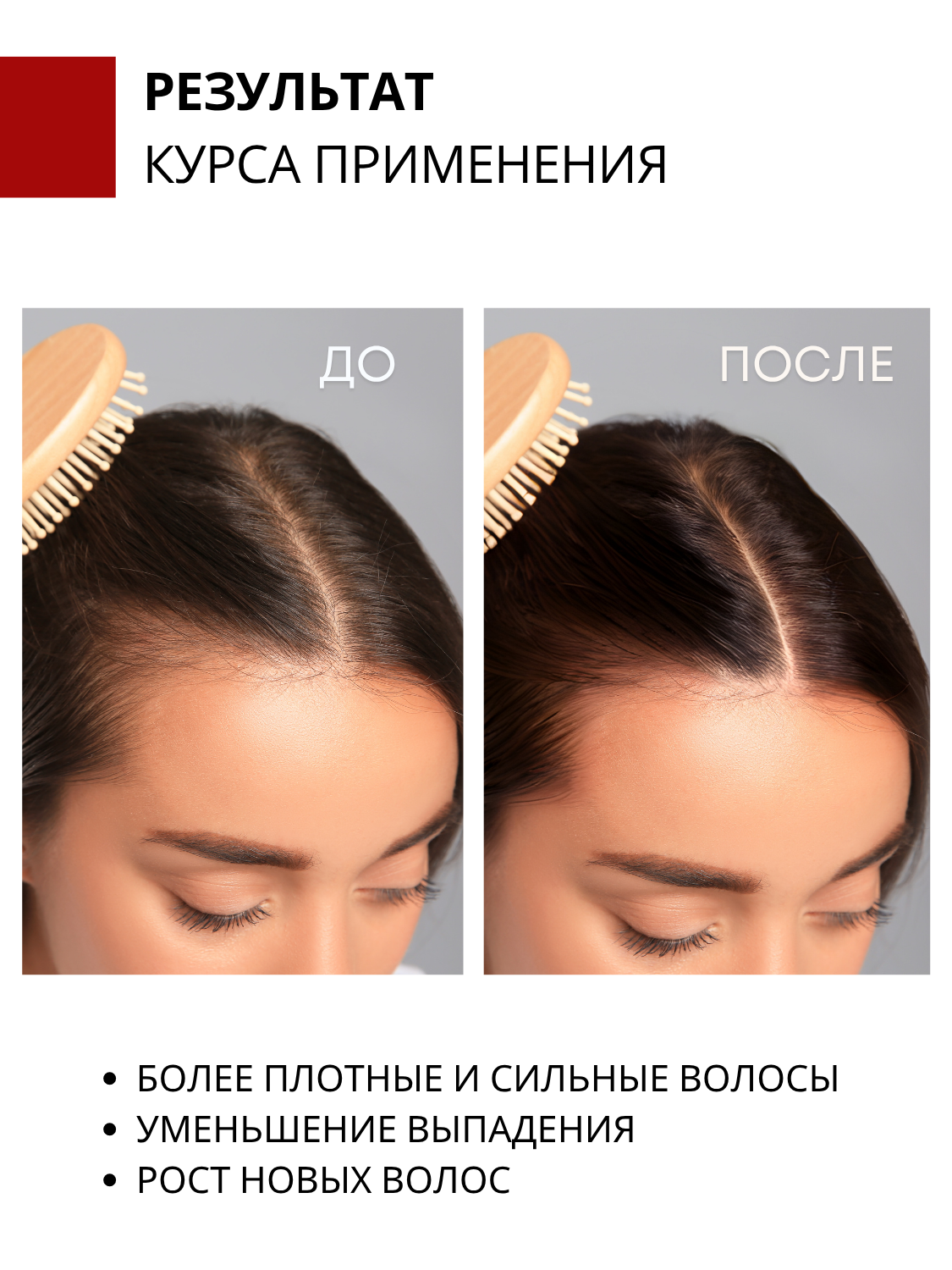 Маска для роста волос и против выпадения с перцем и никотиновой кислотой, активатор роста DR. MARCUS HEILER, 250 мл — фото 1