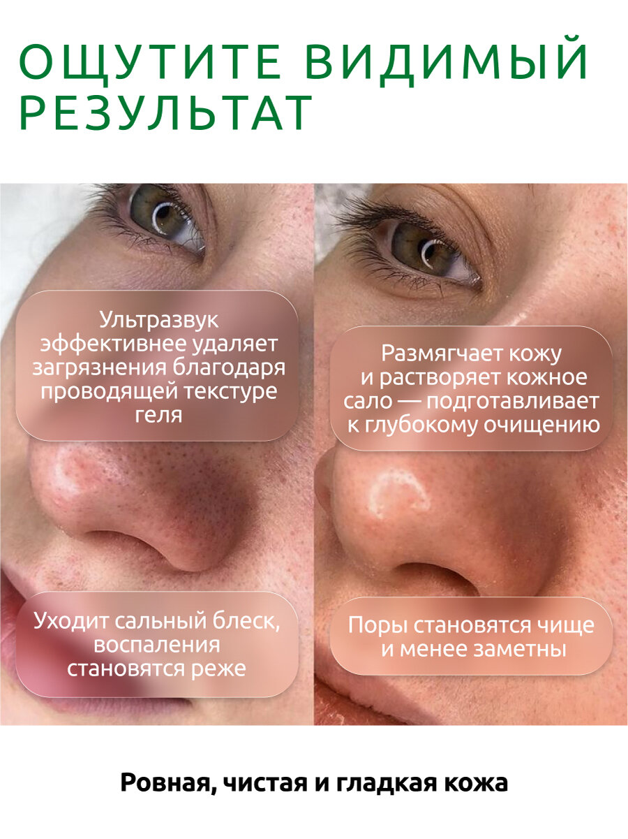 Гели Для Лица ReadySkin Care Ultraclean Gel / гель с алоэ вера для ультразвуковой чистки и дезинкрустации, 250 мл.