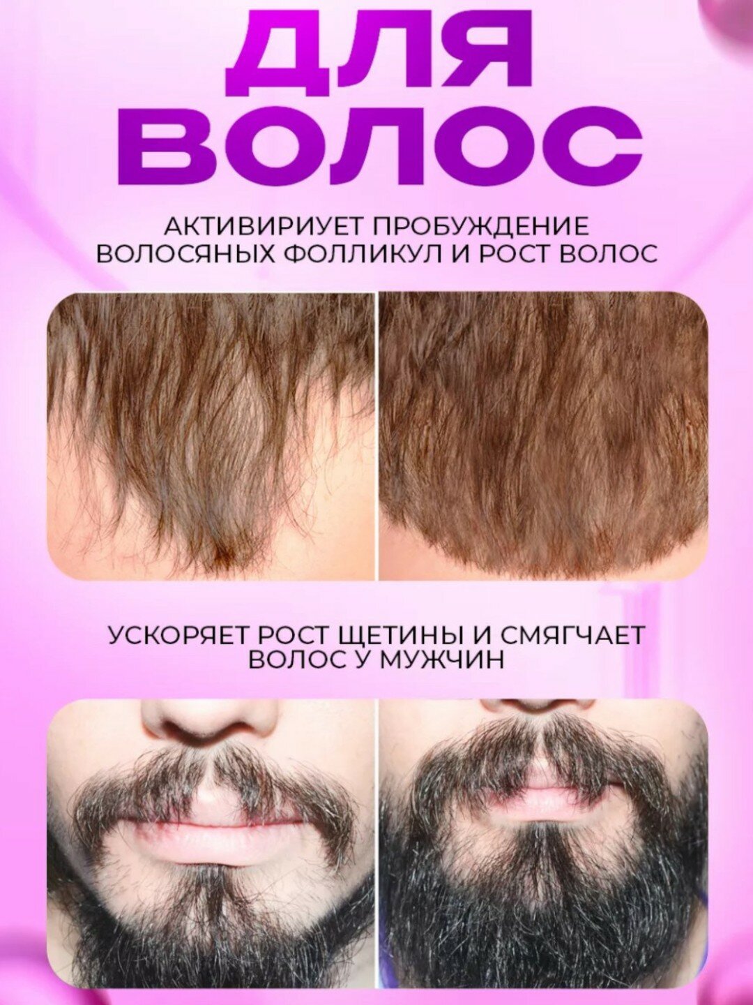 Дермороллер для усиления действия миноксидила Derma roller system — фото 1