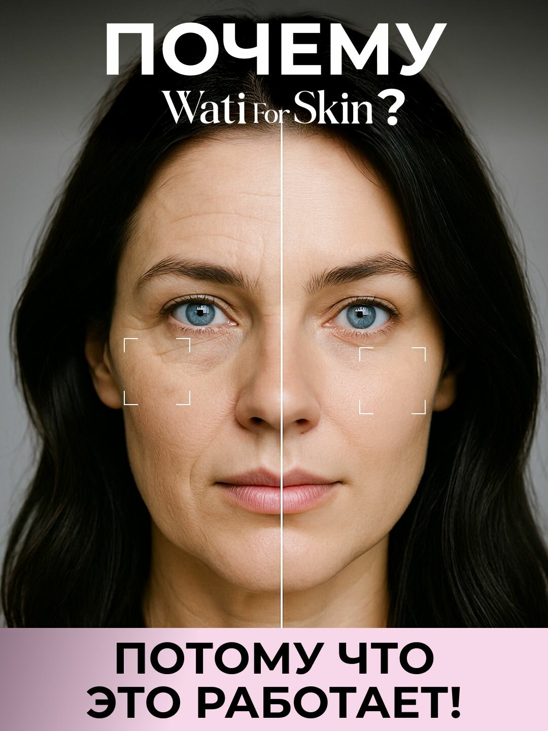 Сыворотки Для Лица Сыворотка с микроиглами для лица, Wati for Skin, антивозрастная со спикулами, от морщин корейская, 30мл