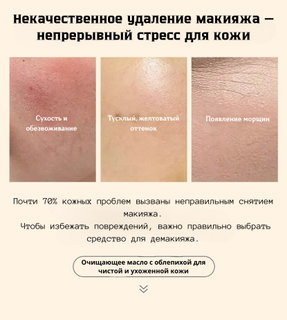 Очищающее масло HIPPOPHAE RHAMNOIDES, осветляет, увлажняет и удаляет макияж — фото 1