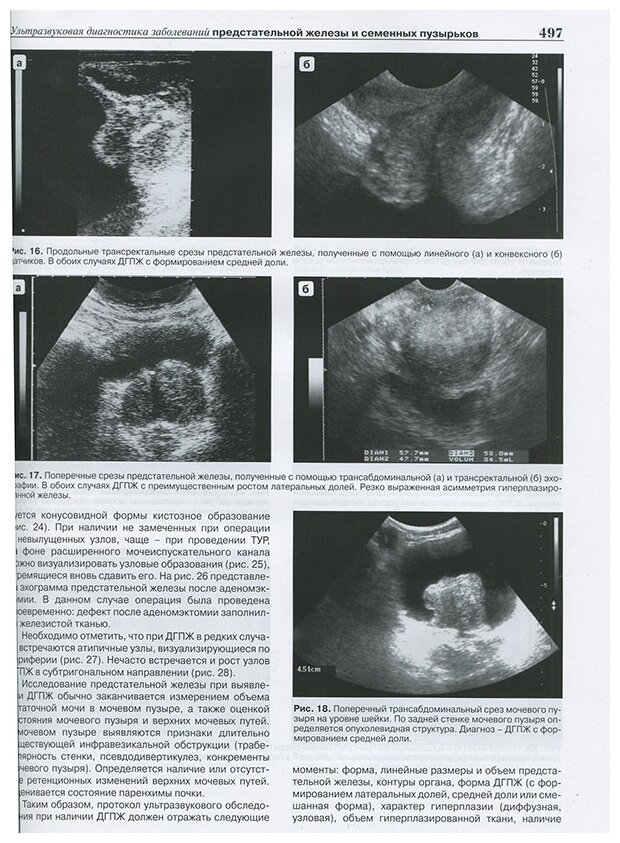 Книга Практическое руководство по ультразвуковой диагностике. 3-е изд. Общая ... - фото №5