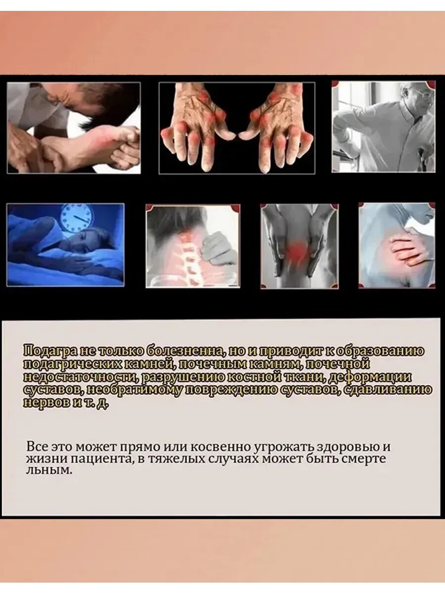 Изображение ОбезболиваюшаЯ мазь длЯ суставов, 55 г