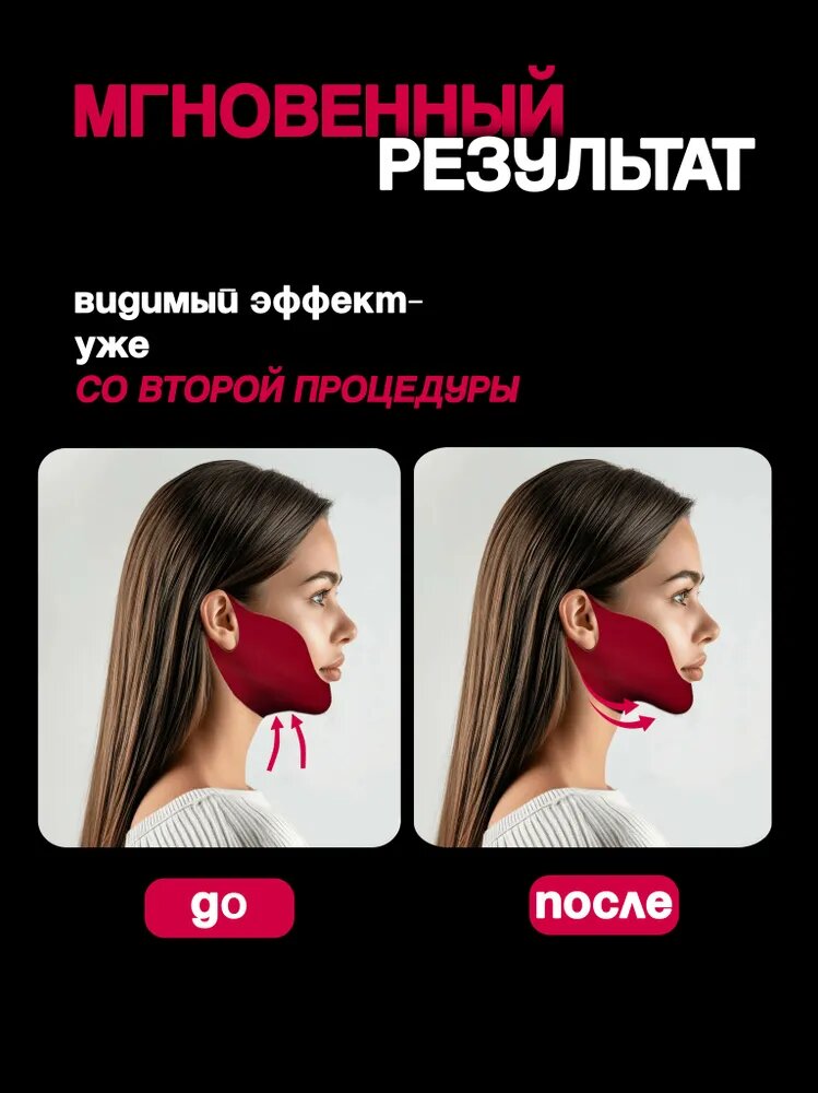 Маска для подбородка, лифтинг-маска для коррекции овала лица — фото 1