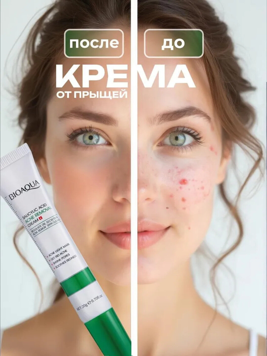 Крем от прыщей акне и черных точек BIOAQUA концентрированный, с салициловой кислотой