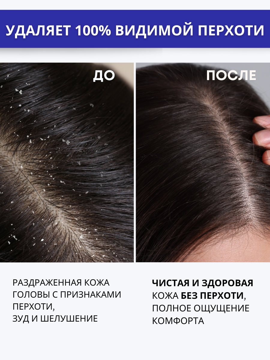 Препараты От Заболеваний Кожи Головы Шампунь от перхоти сульсен + цинк для жирной кожи головы, 250 мл, Doctor Heiler