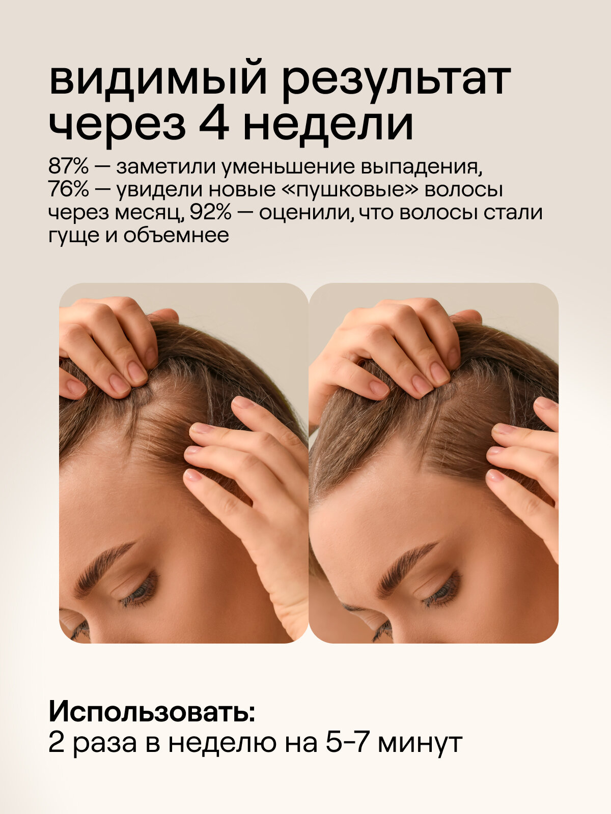 Маски Для Волос Маска для волос 4FRESH "Активный рост", сохранение длины, 300 мл