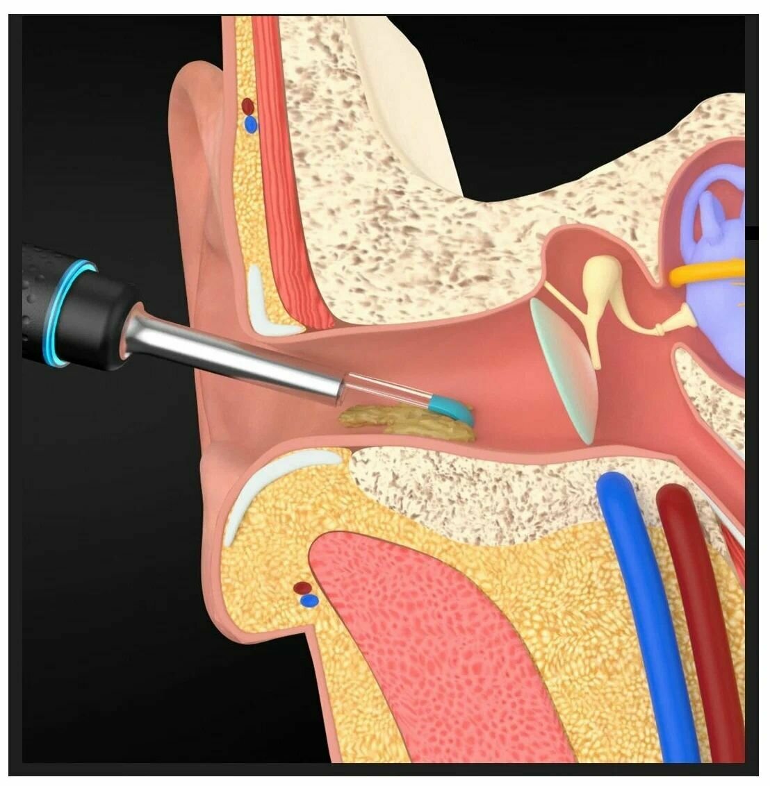 Ушные Палочки Xiaomi Умная ушная палочка Xiaomi Bebird M9 S Smart Visual Ear Rod, черный