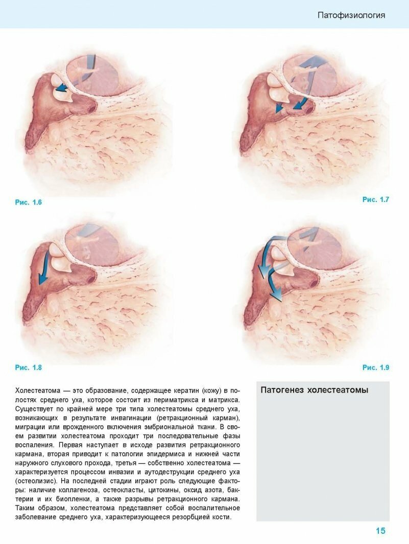 Хирургия среднего уха. Атлас (Герсдорф Мишель, Жерар Жан-Марк) - фото №4