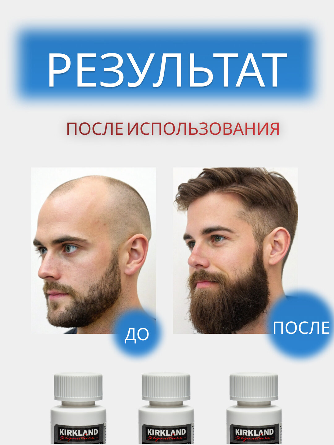 Миноксидиl для роста волос Minoxidil, 5%, для волос и бороды, 60мл — фото 1