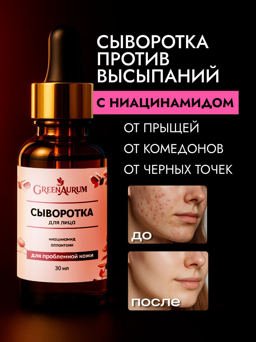Сыворотка для лица от прыщей и акне с ниацинамидом, себорегулирующая, 30 мл фото
