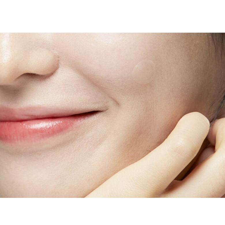 Патчи Madeca Medi Patch – твой SOS-помощник в борьбе с прыщами — фото 1