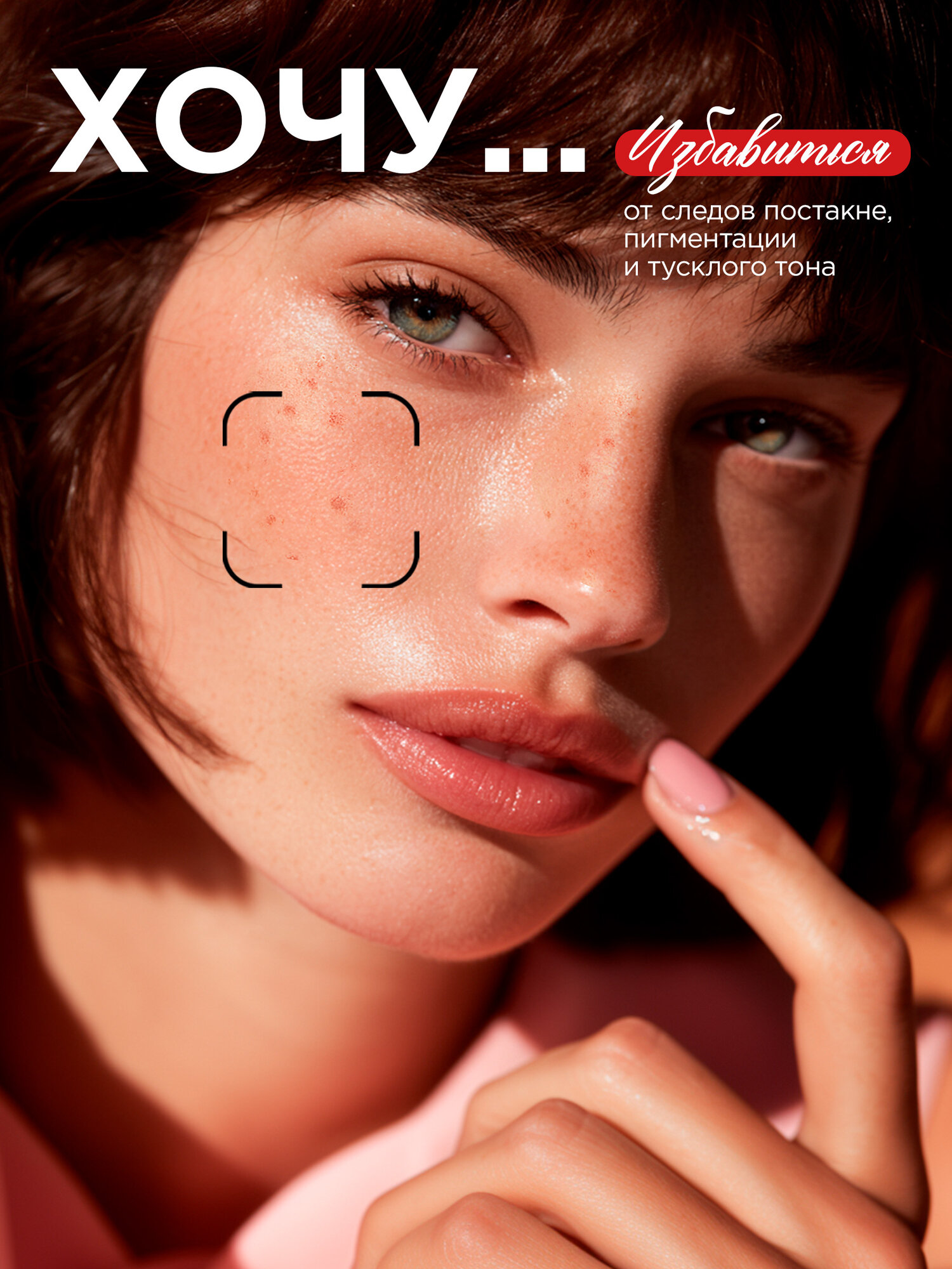 MIXIT Сыворотка для лица против акне и постакне с ниацинамидом, SKIN CHEMISTRY 30 мл — фото 1