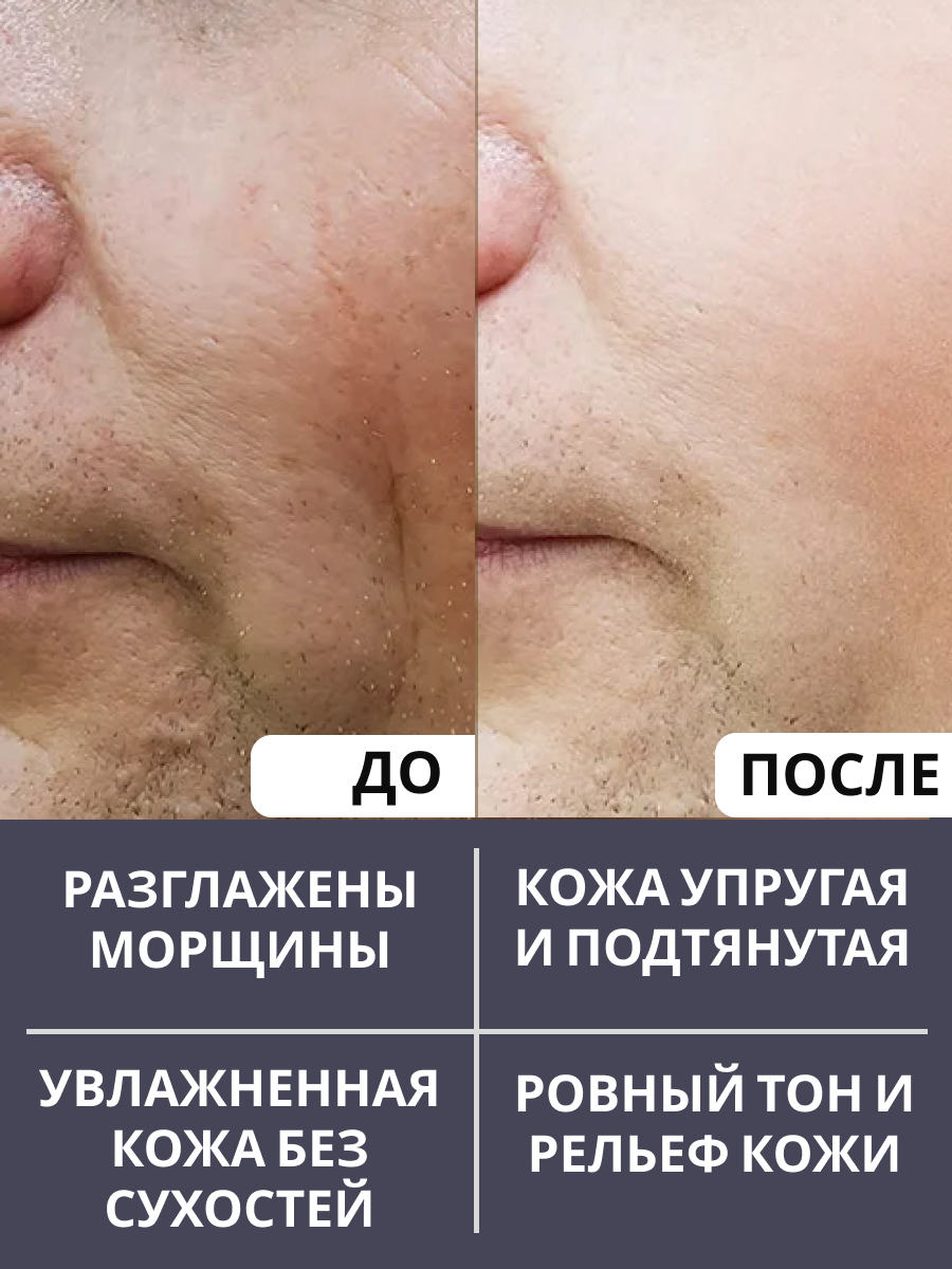 Крем Для Лица Мужской Крем для лица мужской против морщин, Эффект ботокса, коллаген и ретинол, 50 мл