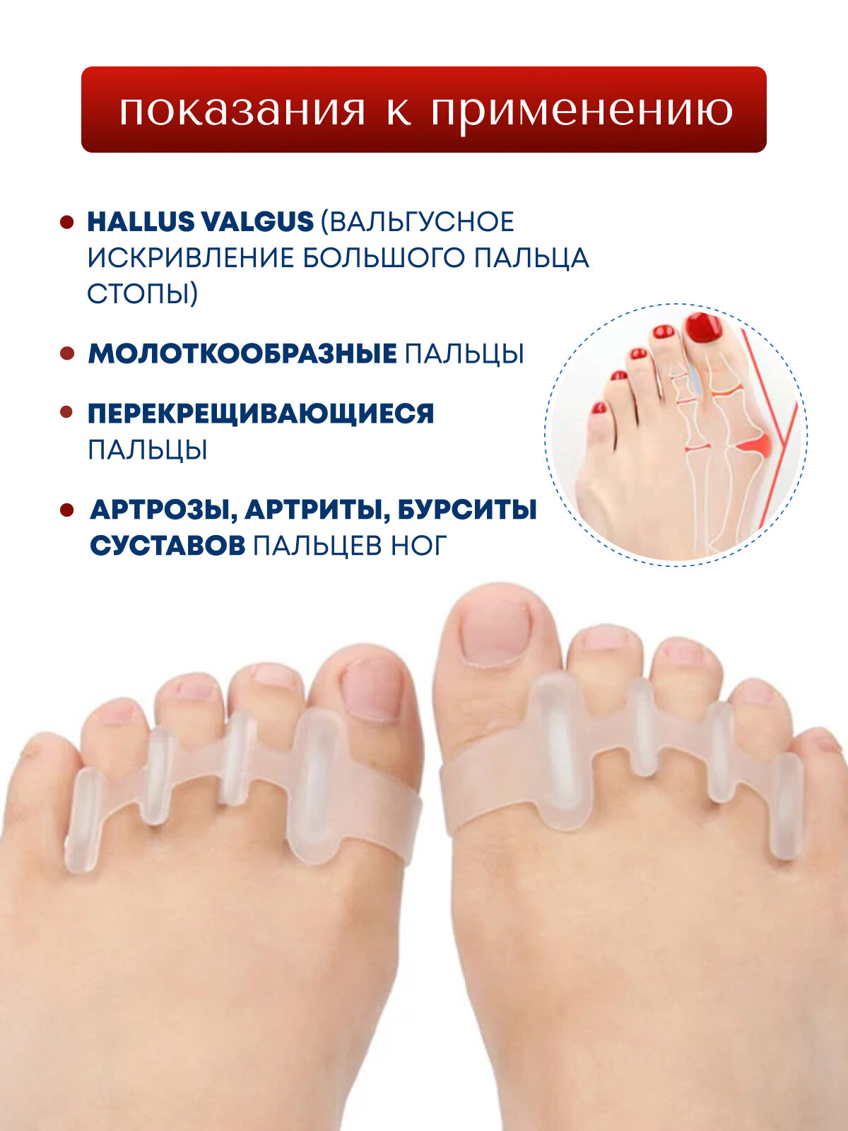 Картинки Разделитель для пальцев ног MyBalance, на все пальцы, силиконовые, ортопедические, размер универсальный, белый, 2 шт
