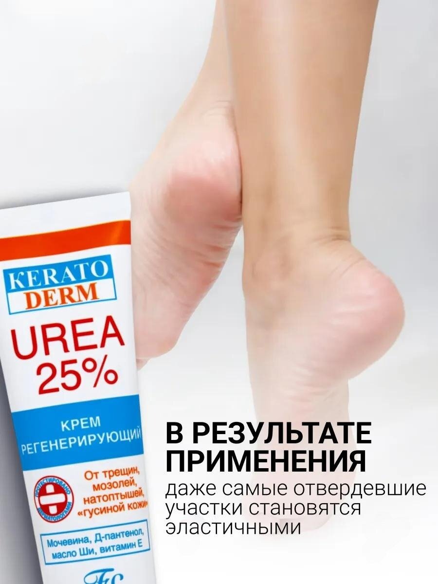 Крем для ног Floresan Ф-618 "Кератодерм" с мочевиной, регенерирующий, 25% мочевины, 100 мл — фото 1