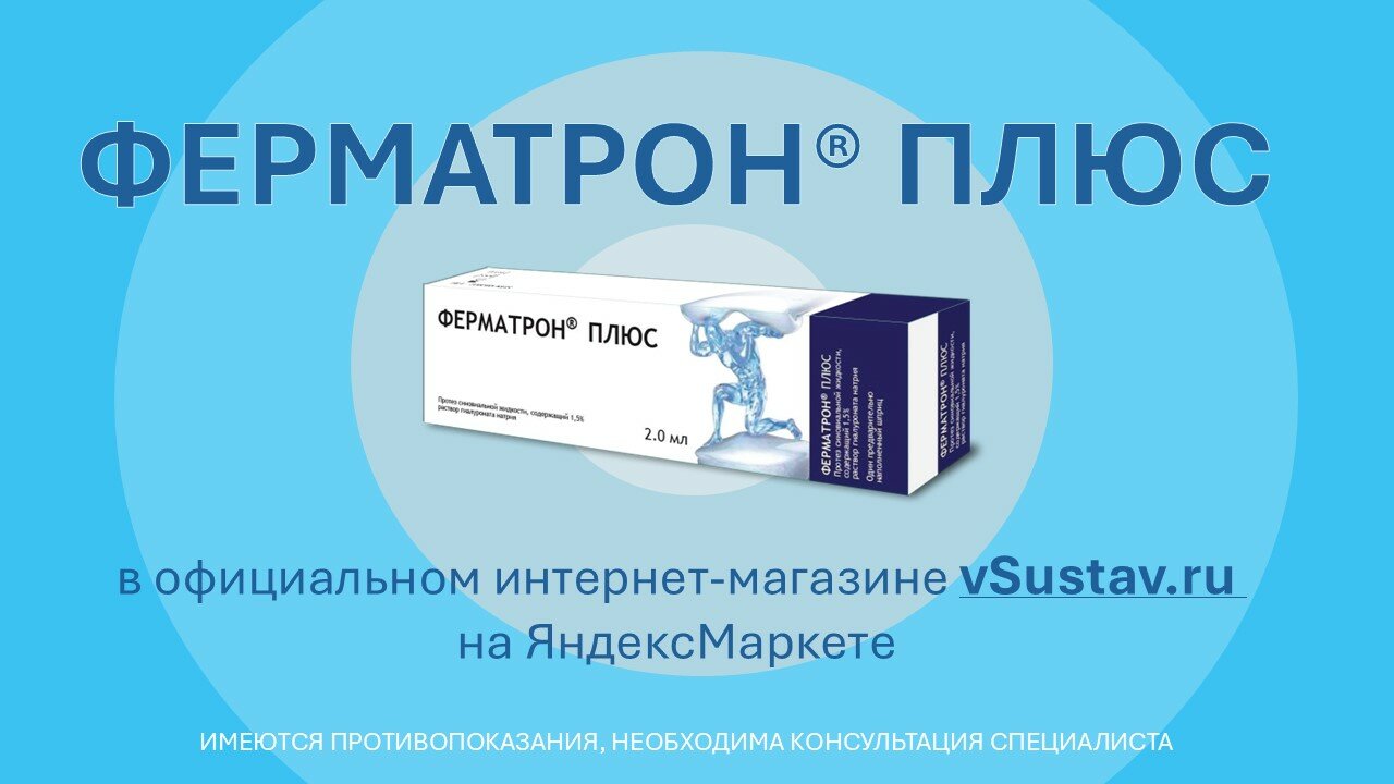 Протезы Внутрисуставной Жидкости ФЕРМАТРОН® Плюс, раствор для внутрисуставного введения на основе гиалуроновой кислоты 1,5% (15 мг/мл), 2 мл
