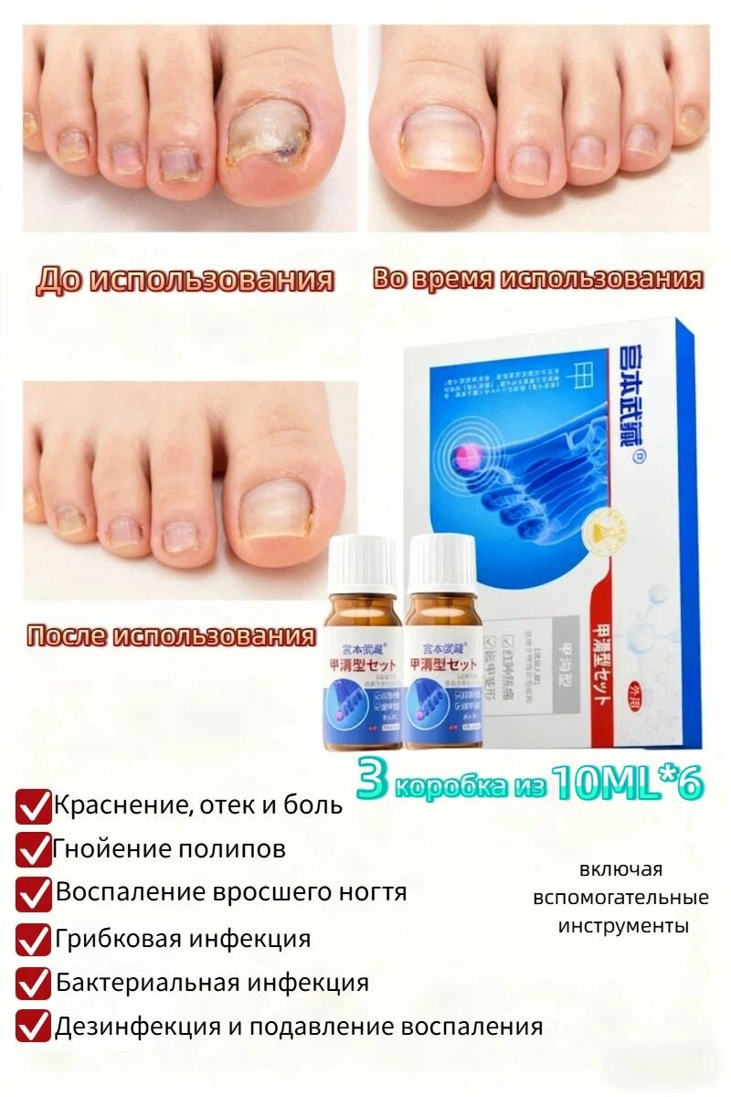 Гиалуроновая сыворотка: восстановление и уход при панариции