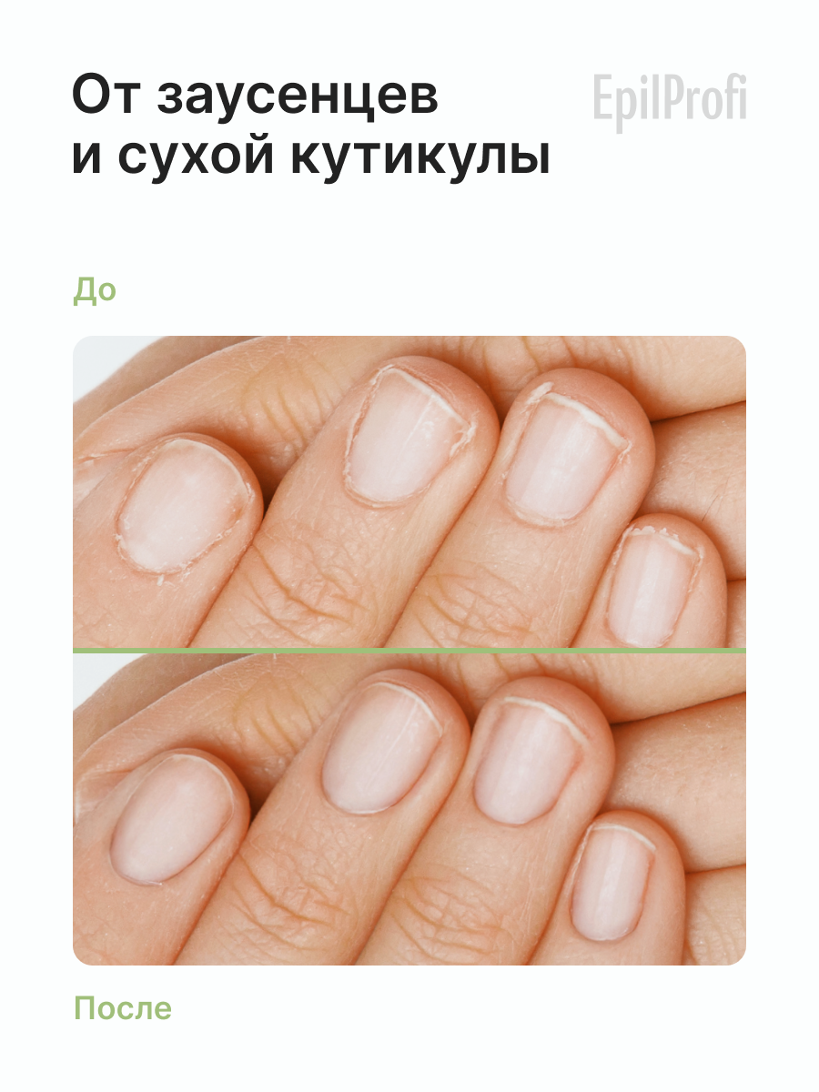 EpilProfi Масло для кутикулы и ногтей с эфирным маслом чайного дерева, для укрепления и востановления, 10 мл — фото 1